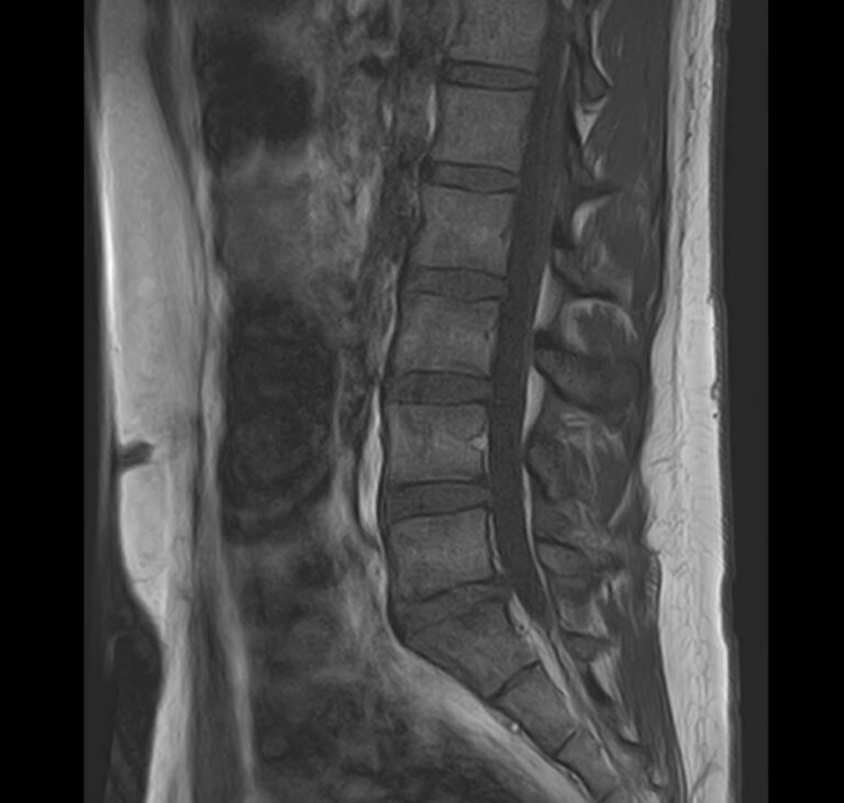 МРТ центральной нервной системы (ЦНС)