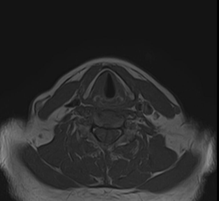 МРТ мягких тканей шеи