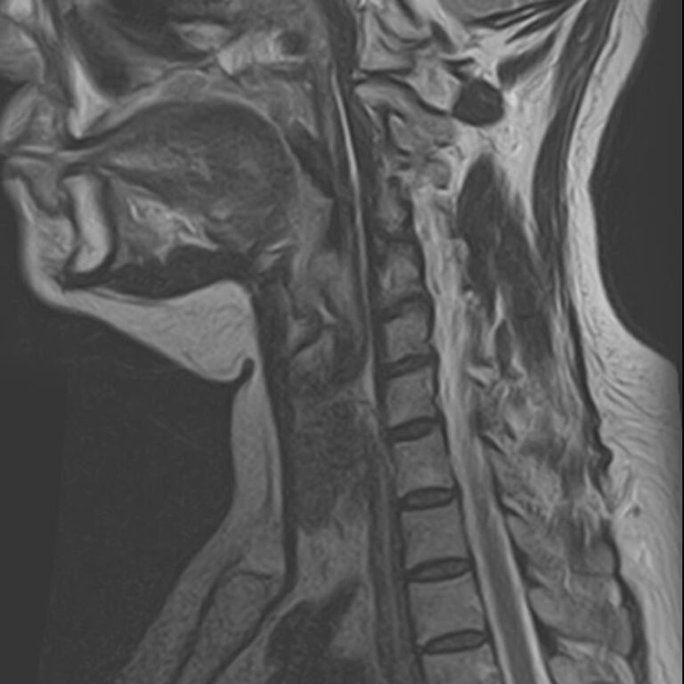 МРТ мягких тканей шеи