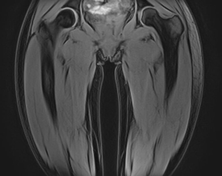 МР-скрининг всего тела