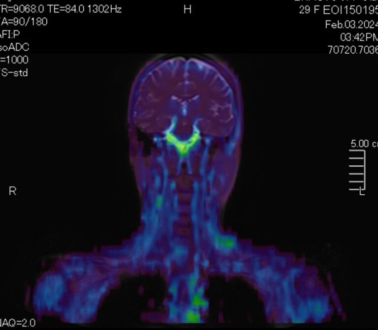МР-скрининг всего тела