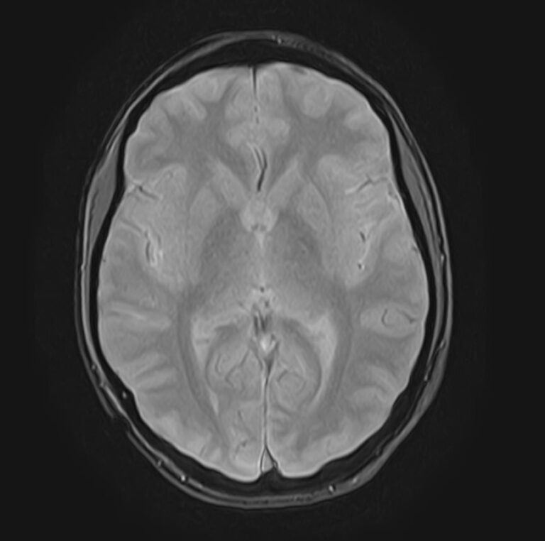 МРТ головного мозга + шейного отдела позвоночника