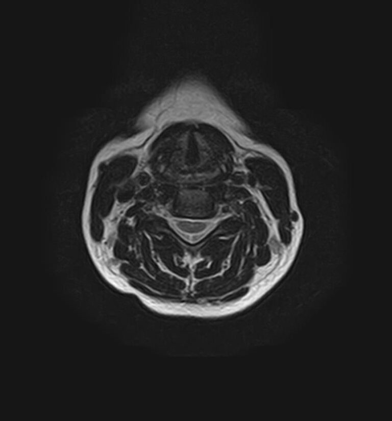 МРТ головного мозга + шейного отдела позвоночника