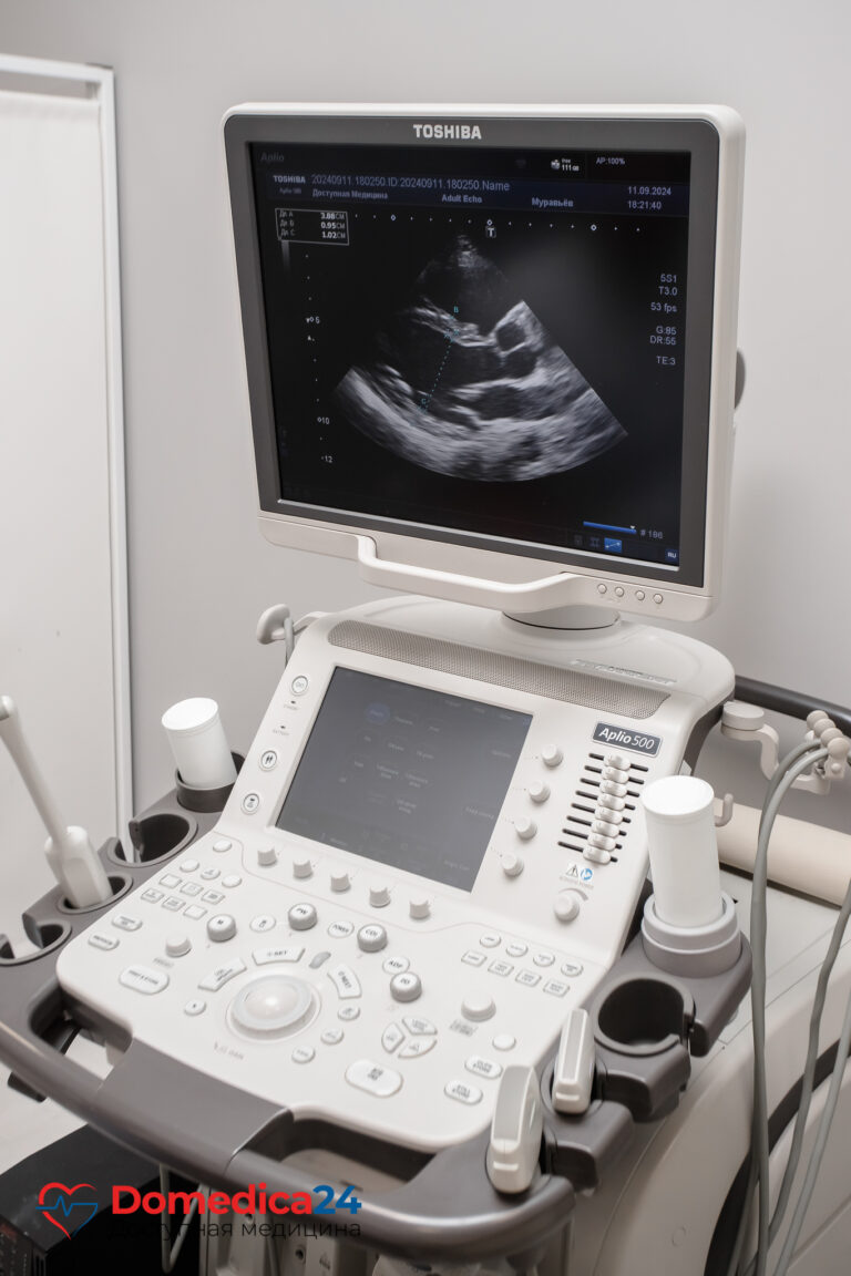Эхокардиография УЗИ сердца