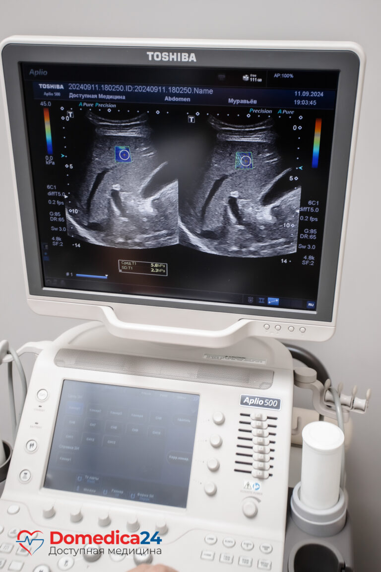 Эластография печени