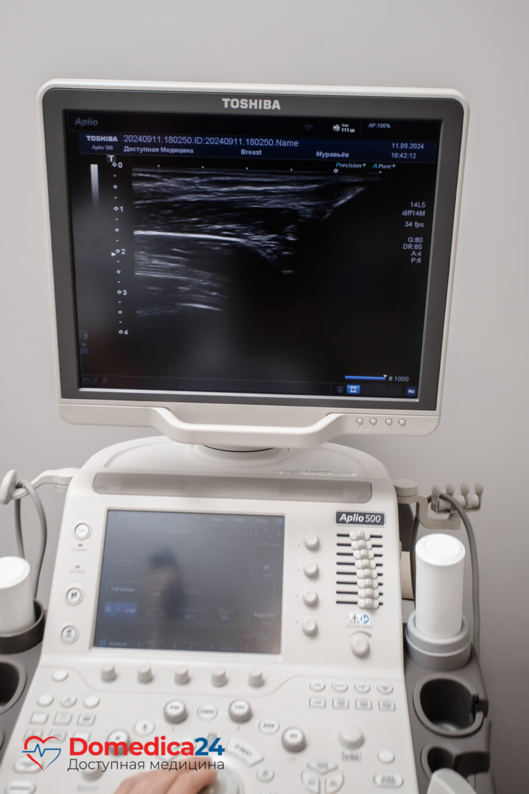 УЗИ коленного сустава