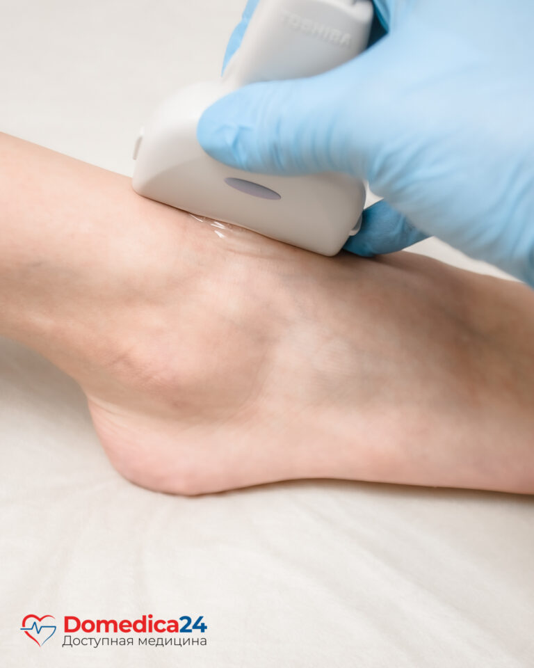 УЗИ межфаланговых суставов