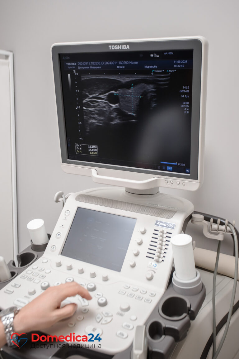 УЗИ щитовидной железы