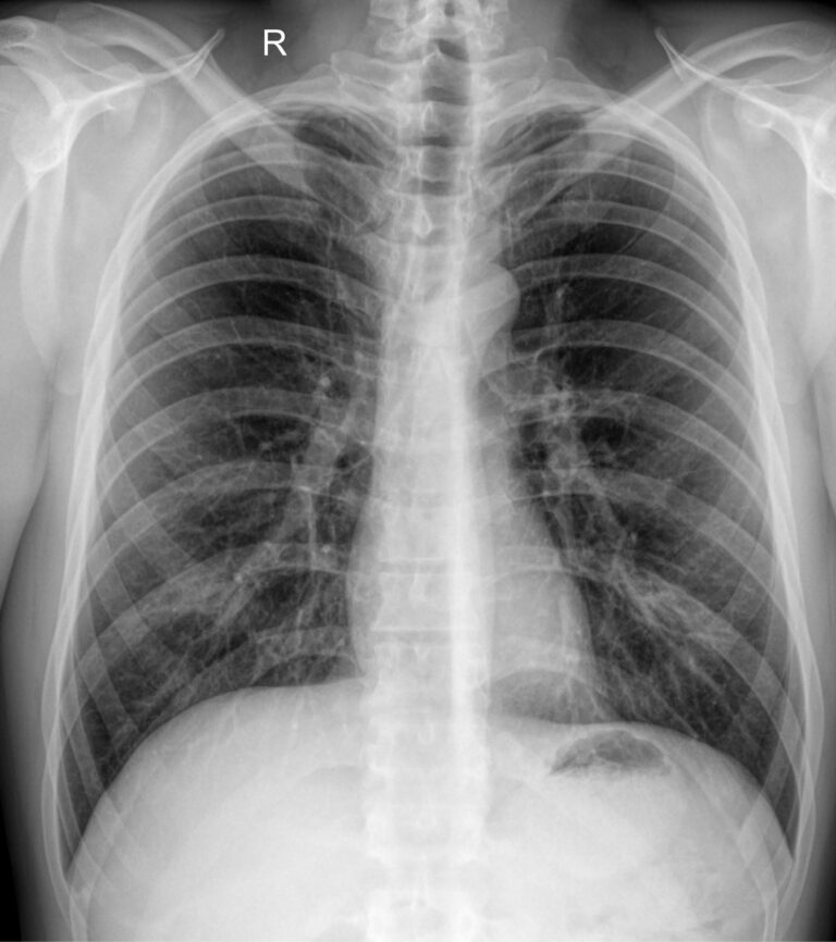 Флюорография