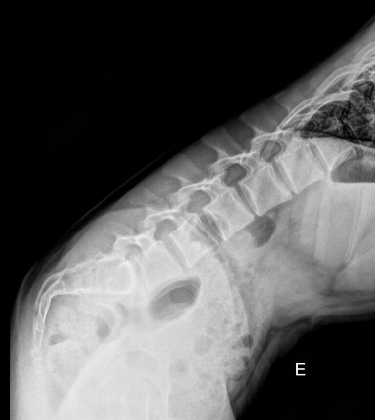 Функциональные исследования позвоночника (поясничный отдел)