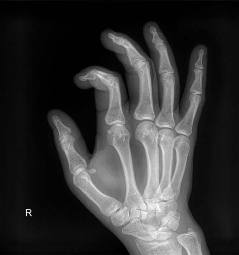 Рентген кисти