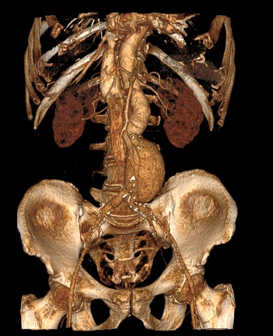 КТ контрастирование КТ с контрастом