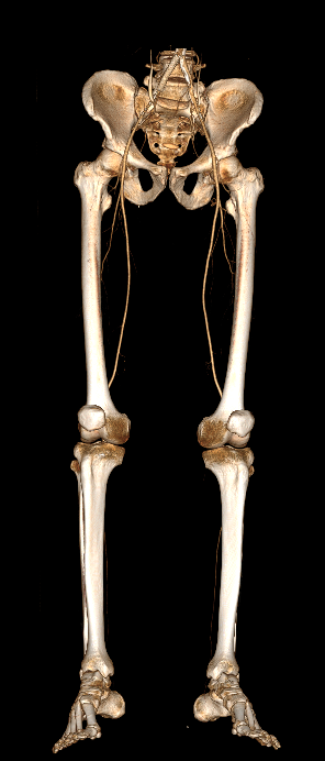КТ с контрастом противопоказания для КТ с контрастом
