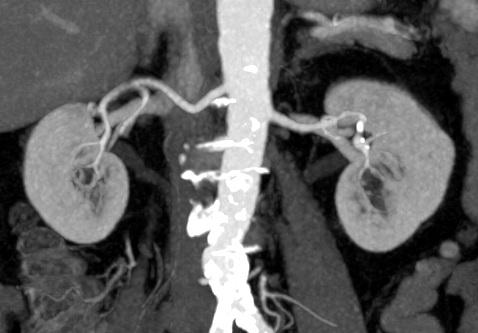 компьютерная томография с контрастом КТ с контрастом