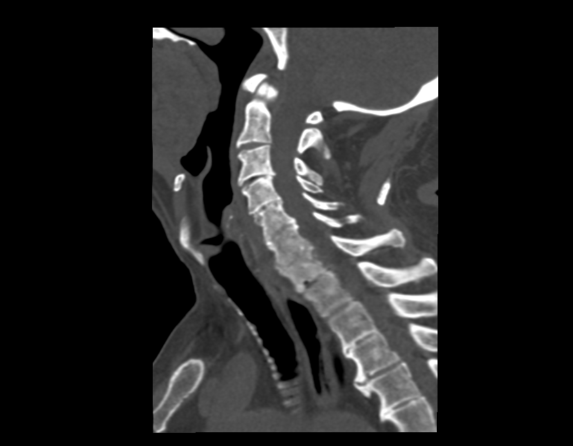КТ излучение КТ исследование
