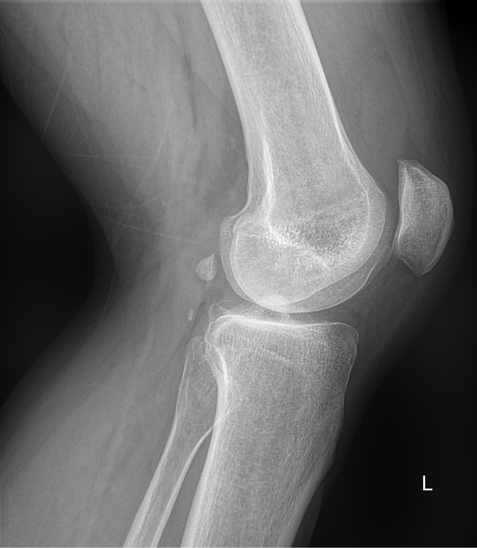 рентген крупных суставов рентген коленного сустава