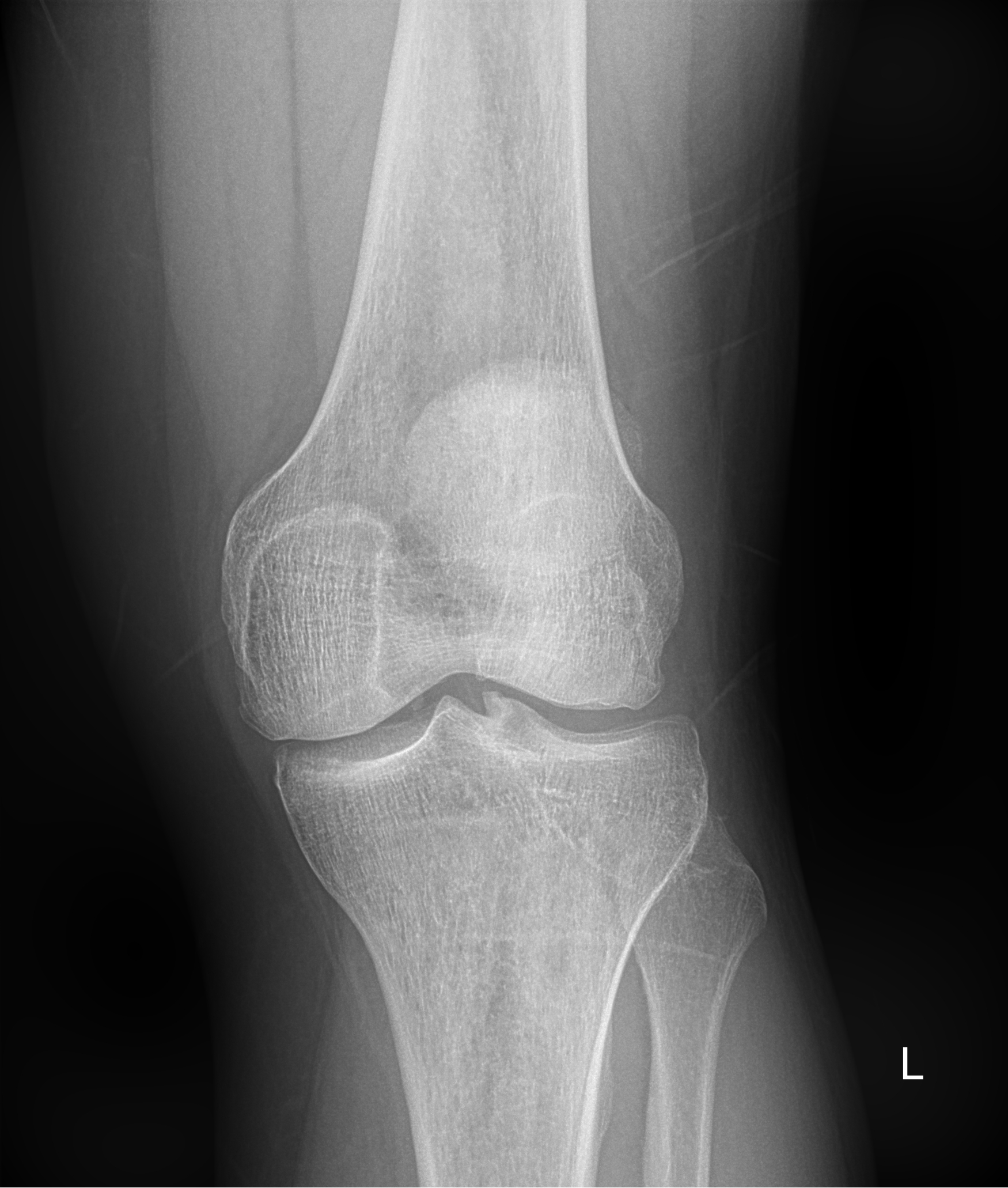 рентген крупных суставов рентген коленного сустава