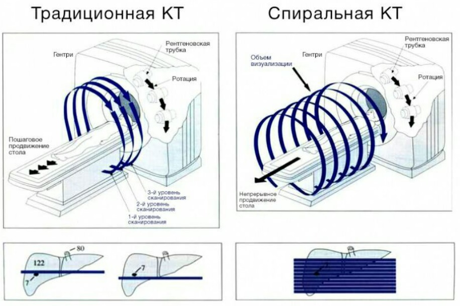 принцип работы КТ физические основы КТ