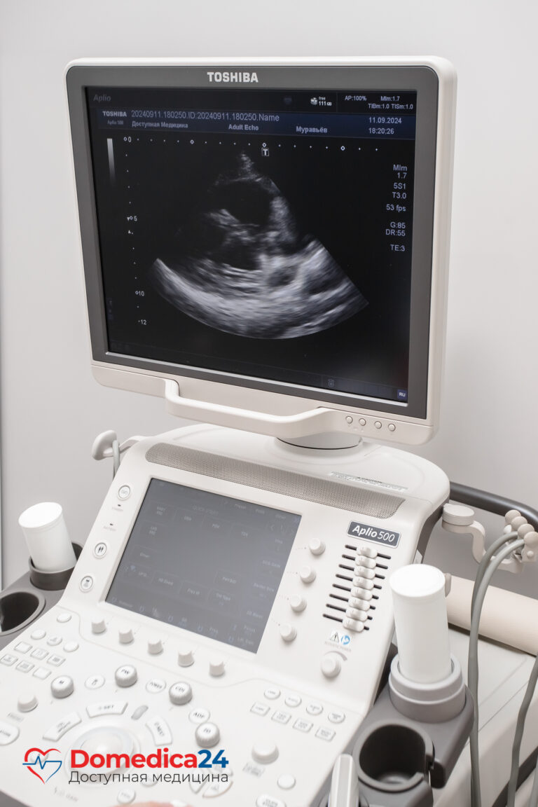 Эхокардиография УЗИ сердца